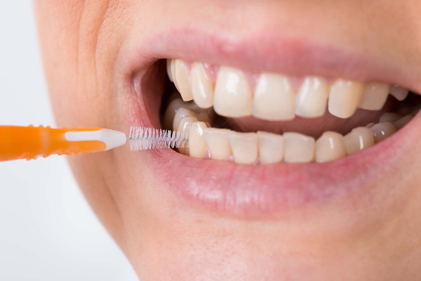 cepillo-dientes-interdental
