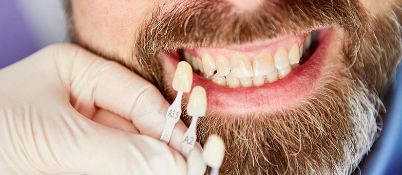 Paciente con manchas blancas en los dientes
