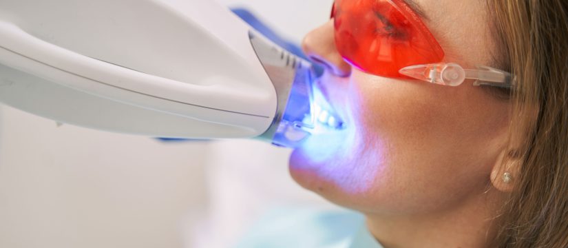 mujer en proceso del blanqueamiento dental en clínica